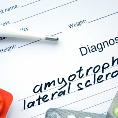 6 Tips for Managing Amyotrophic Lateral Sclerosis