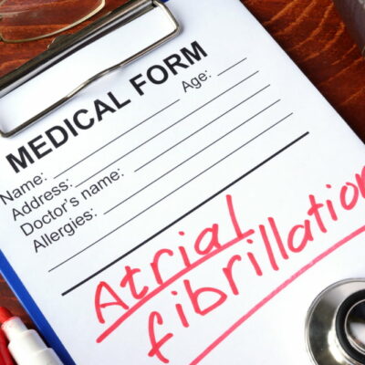6 Common Atrial Fibrillation Symptoms