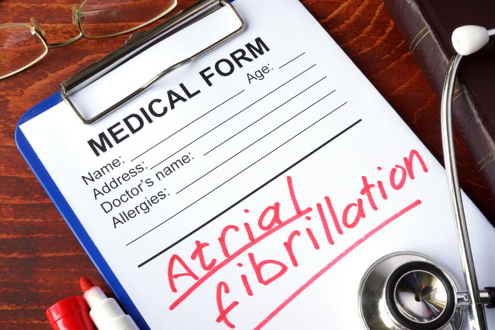 6 Common Atrial Fibrillation Symptoms