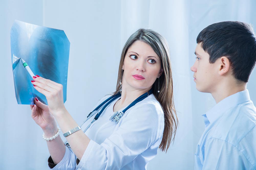 4 Tips to Prevent Small-Cell Lung Cancer